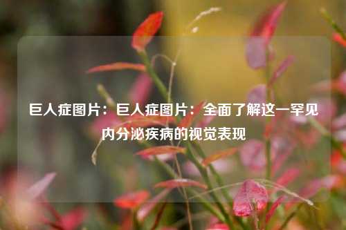 巨人症图片：巨人症图片：全面了解这一罕见内分泌疾病的视觉表现